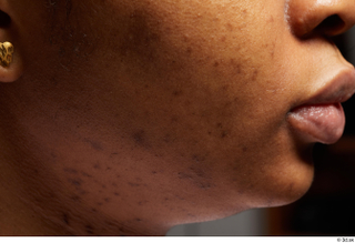 HD Face skin Calneshia Mason cheek lips pores skin texture…